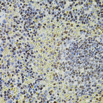 Immunohistochemistry - POT1 antibody (144-01491)