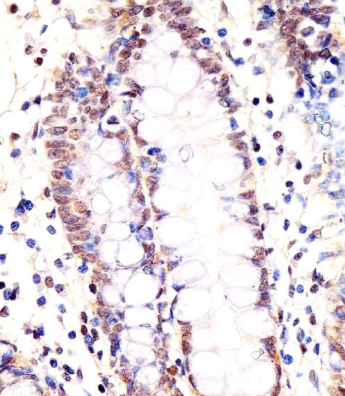 IHC-P