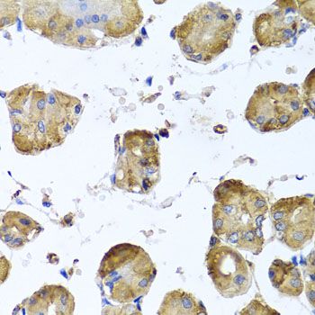 Immunohistochemistry - TUBB8 antibody (144-12617)