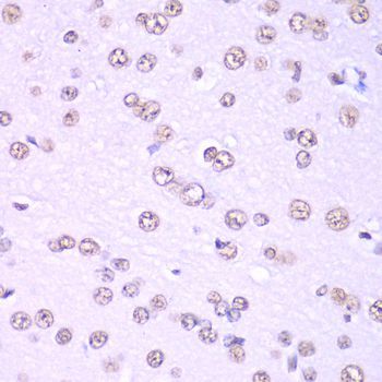 Immunohistochemistry - Nono Antibody (144-05282)