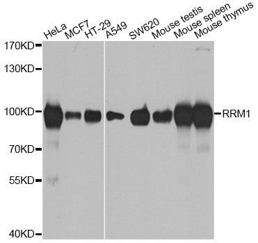 Western blot - RRM1 Polyclonal Antibody (144-01152)