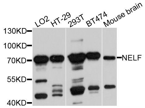 Western blot - NSMF Polyclonal Antibody (144-04603)