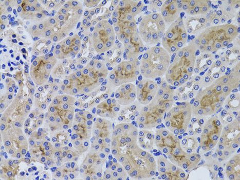 Immunohistochemistry - GGT1 antibody (144-01776)