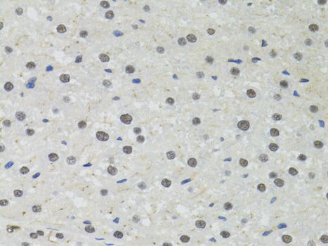 Immunohistochemistry - PPP4C Polyclonal Antibody (144-02109)