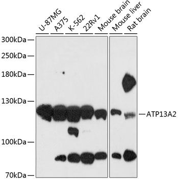 Western blot