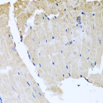 Immunohistochemistry - RAB24 Polyclonal Antibody (144-08394)