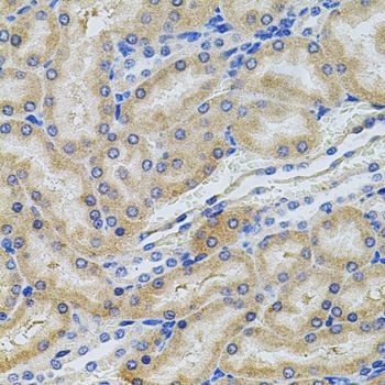 Immunohistochemistry - PCSK9 antibody (144-07860)