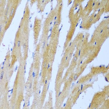 Immunohistochemistry - IGF2BP3 Polyclonal Antibody (144-02750)