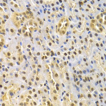 Immunohistochemistry - RUNX1 Antibody (144-02055)