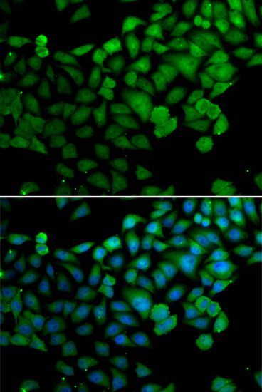 Immunofluorescence - SYNCRIP Polyclonal Antibody (144-07219)