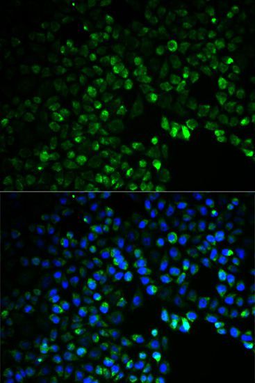 Immunofluorescence - UGDH antibody (144-01210)