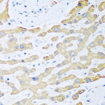 Immunohistochemistry - FDXR antibody (144-03860)