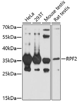 Western blot