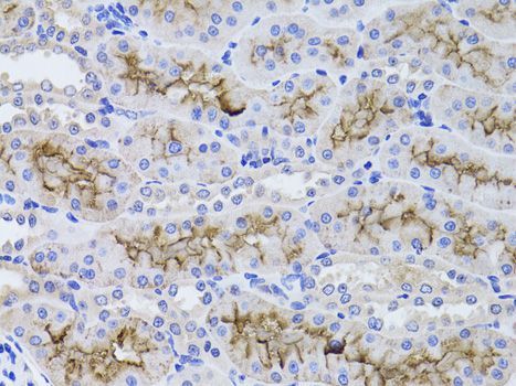 Immunohistochemistry - GGT1 antibody (144-01776)