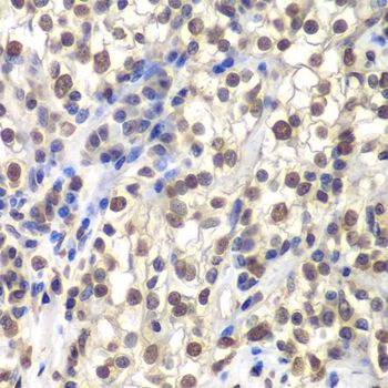 Immunohistochemistry - CENPC Polyclonal Antibody (144-06557)