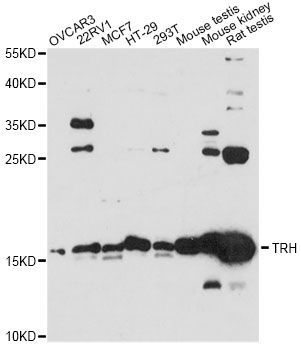 Western blot - KRBOX4 Polyclonal Antibody (144-014514)