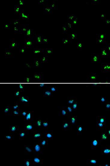 Immunofluorescence - HDAC4 Polyclonal Antibody (144-00239)
