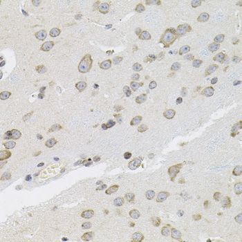 Immunohistochemistry - VEPH1 antibody (144-08510)
