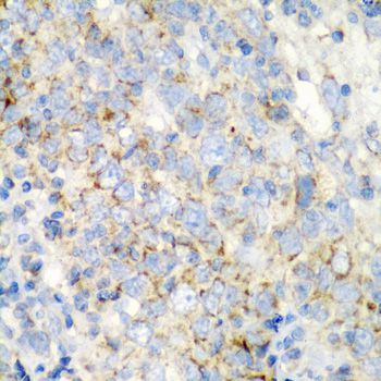 Immunohistochemistry - PRKCQ antibody (144-05834)