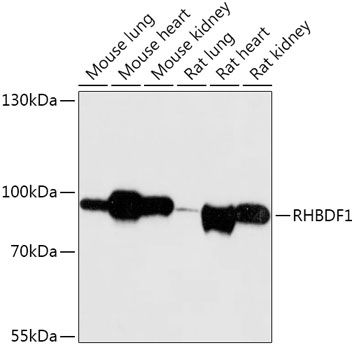 Western blot