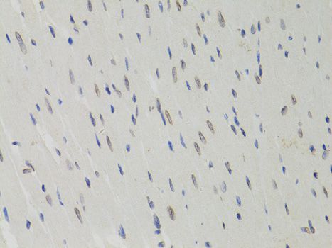 Immunohistochemistry - LMNB1 Polyclonal Antibody (144-01910)