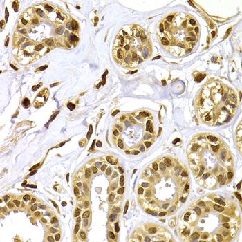 Immunohistochemistry - [KO Validated] S100A4 Polyclonal Antibody (144-01631)