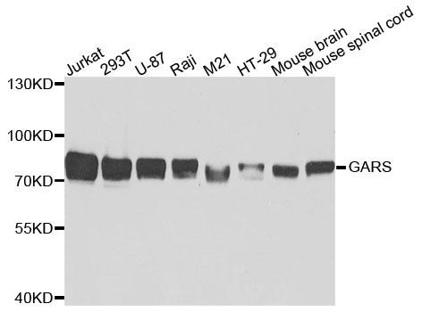 Western blot - GARS Polyclonal Antibody (144-05435)
