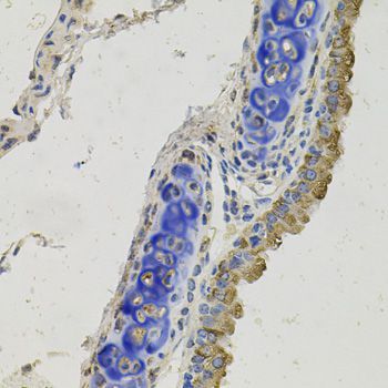 Immunohistochemistry - GAS6 antibody (144-08545)