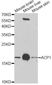 Western blot - ACP1 antibody (144-01801)