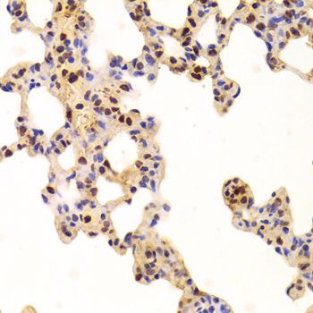 Immunohistochemistry - ANP32A Antibody (144-05768)