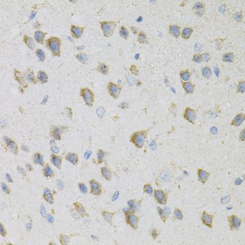 Immunohistochemistry - CDA Polyclonal Antibody (144-013959)