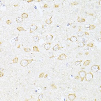 Immunohistochemistry - SQSTM1 Polyclonal Antibody (144-07758)