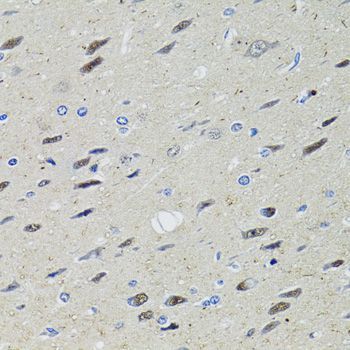 Immunohistochemistry - STAT1 Polyclonal Antibody (144-00027)