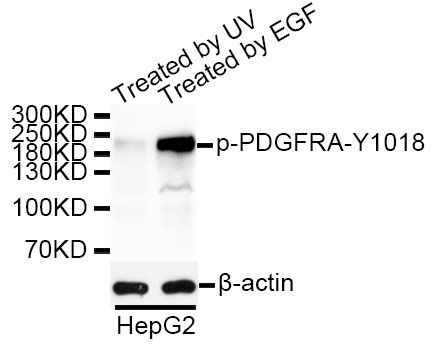 Western blot - Phospho-PDGFRA-Y1018 antibody (144-50615)