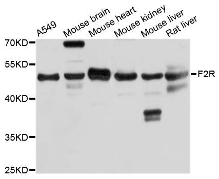 Western blot - F2R antibody (144-05641)