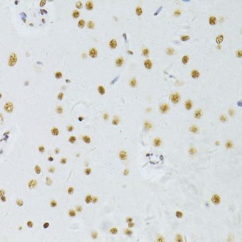 Immunohistochemistry - ALYREF antibody (144-06010)