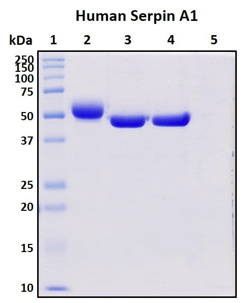 SDS-PAGE