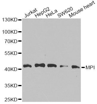 Western blot - MPI Polyclonal Antibody (144-07319)