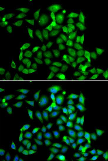 Immunofluorescence - CLASP1 antibody (144-07081)