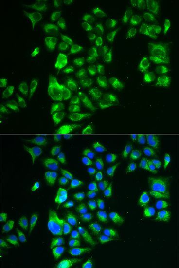 Immunofluorescence - GLUD2 antibody (144-06604)