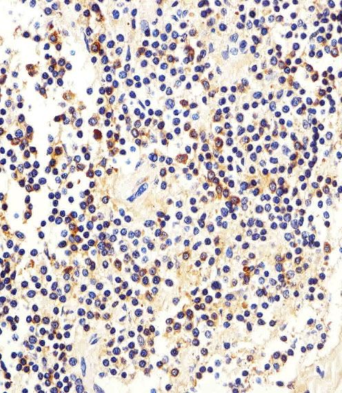 IHC-P