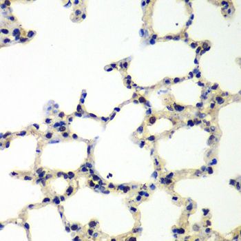 Immunohistochemistry - PNKP antibody (144-06693)