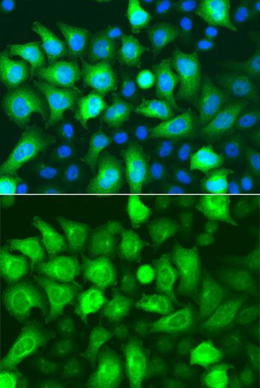 Immunohistochemistry - RRM2 Polyclonal Antibody (144-05255)