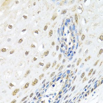 Immunohistochemistry - ELAC2 Polyclonal Antibody (144-07128)