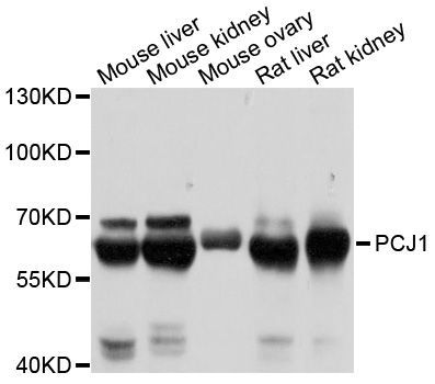 Western blot - PCK1 antibody (144-02036)