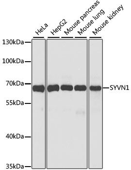 Western blot - SYVN1 antibody (144-02605)