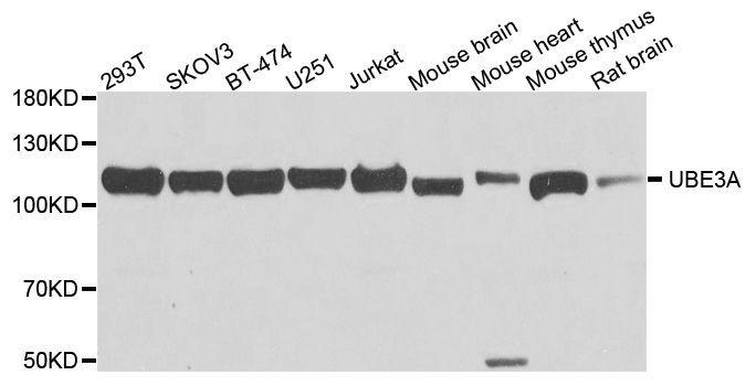 Western blot - UBE3A antibody (144-01757)