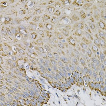 Immunohistochemistry - EFNA1 Polyclonal Antibody (144-05341)