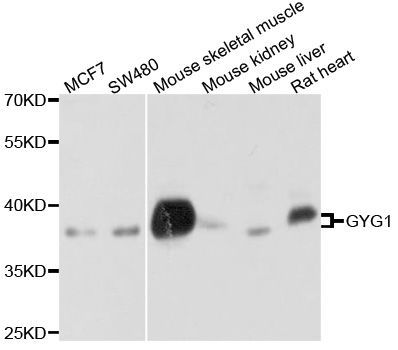 Western blot - GYG1 Polyclonal Antibody (144-010218)