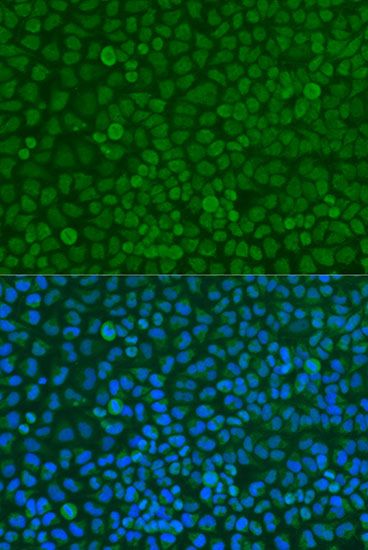 Immunofluorescence - YWHAZ antibody (144-013370)